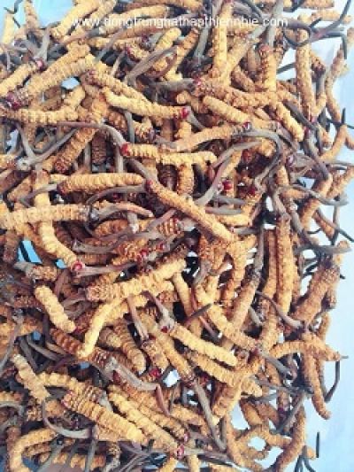 Nhồi máu cơ tim sau 30 năm hút thuốc lá