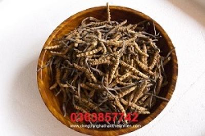 Gout - bệnh của &#039;nhà giàu&#039;