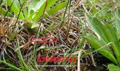 Giảm 60 kg sau phẫu thuật thu nhỏ dạ dày