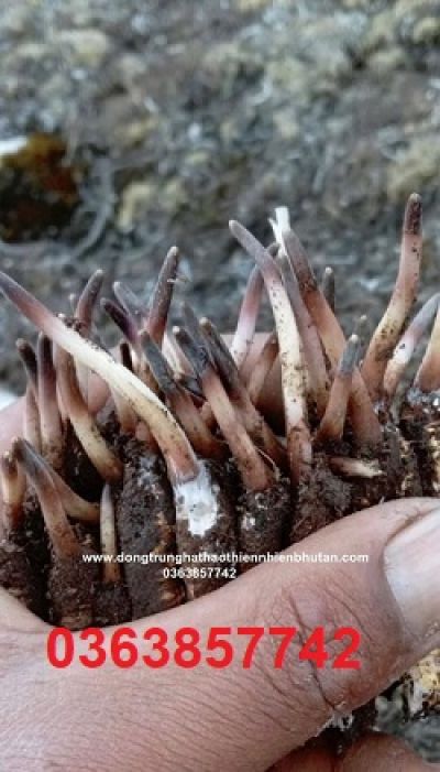 Uống &iacute;t nước, thận 'gồng m&igrave;nh' mỗi ng&agrave;y