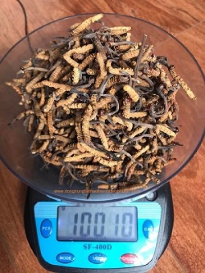 AI ng&agrave;y c&agrave;ng giỏi, nhưng v&igrave; sao kh&ocirc;ng thể thay thế b&aacute;c sĩ?